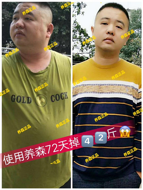 養森瘦瘦包減重效果如何?療程結束後會反彈嗎?